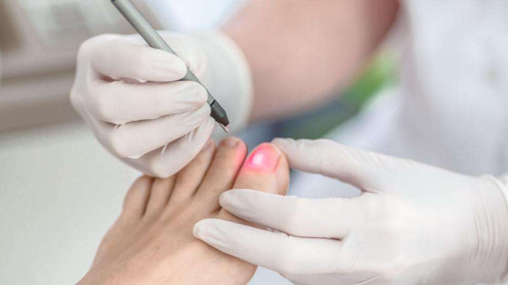 tratamientos-laser cpsalud.com